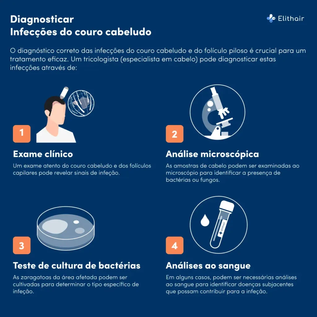 Os passos para diagnosticar a inflamação do couro cabeludo